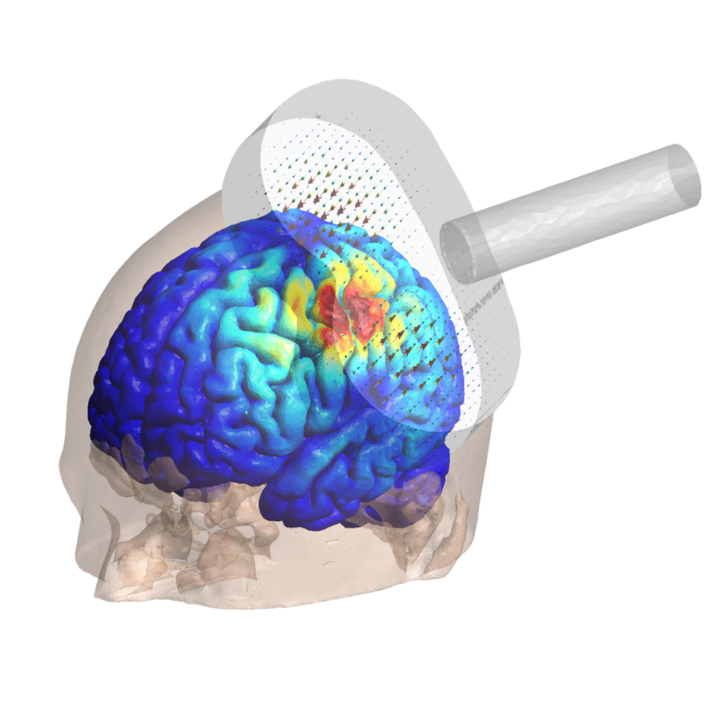 TMS simulator brain skull